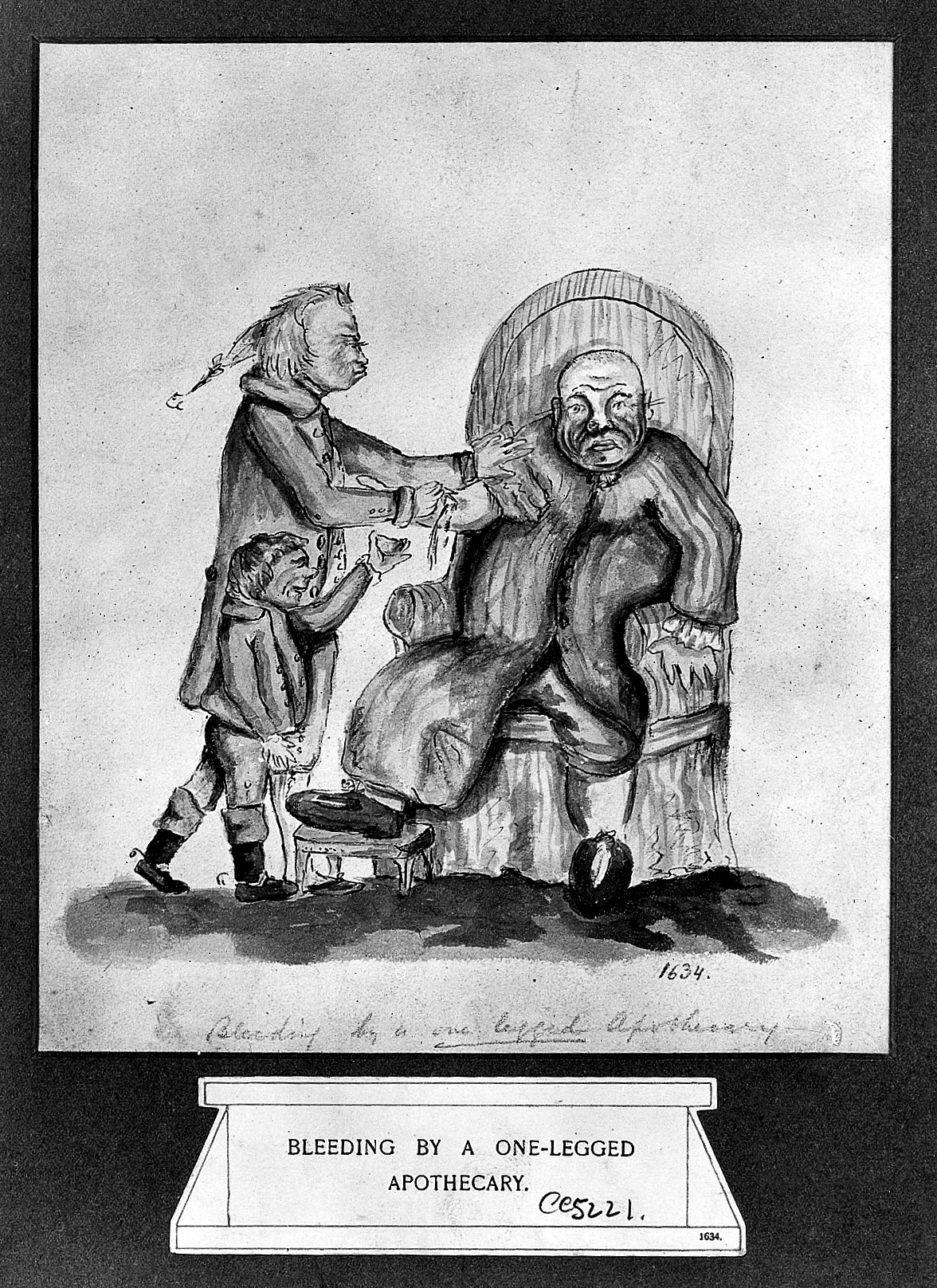 Illustration médiévale d'une saignée thérapeutique avec lancette et patient